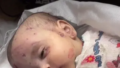 اخبار اليمن الان يوما الاحتلال الاسرائيلي يقتل طفلا اخبار اليمن الان الحدث اليوم عاجل