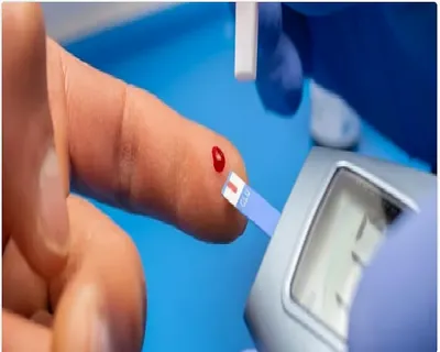 اخبار اليمن الان جفاف والجلد أعراض الإصابة السكري اخبار اليمن الان الحدث اليوم عاجل