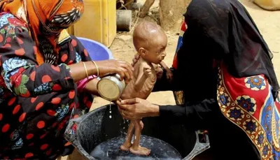 اخبار اليمن الان منظمات دولية انعدام الأمن الغذائي اخبار اليمن الان الحدث اليوم عاجل