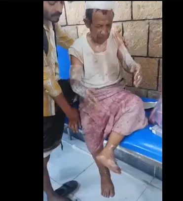 اخبار اليمن الان جريمة صادمة إحراق بائع زلابيا اخبار اليمن الان الحدث اليوم عاجل