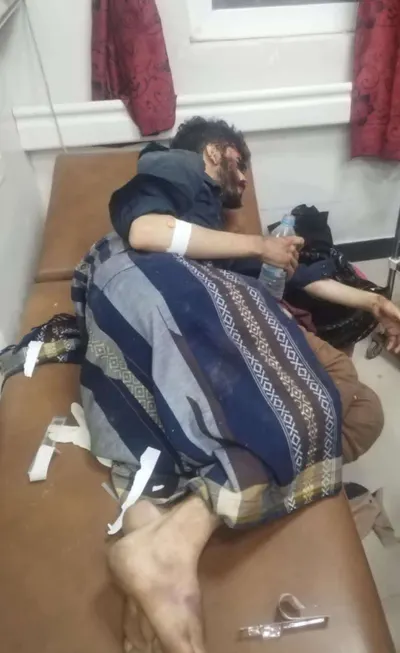 اخبار اليمن الان إصابة شاب بحادث سيارة هيلوكس اخبار اليمن الان الحدث اليوم عاجل