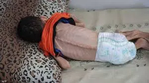 اخبار اليمن الان وفاة المجاعة وحياة مهددة بالموت اخبار اليمن الان الحدث اليوم عاجل