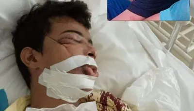 اخبار اليمن الان تابع للعمالقة يدهس ويلوذ بالفرار اخبار اليمن الان الحدث اليوم عاجل