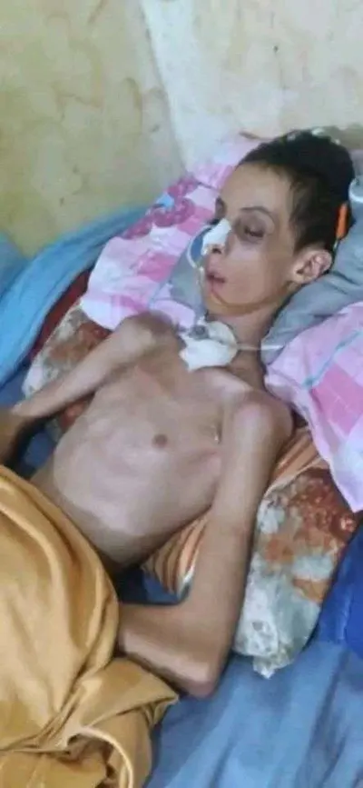 اخبار اليمن الان الحدث اليوم عاجل 