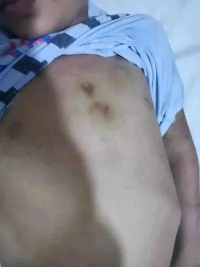 اخبار اليمن الان الحدث اليوم عاجل 