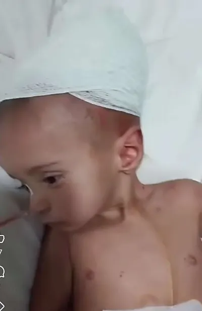 اخبار اليمن الان لإنقاذ عملية الدماغ بمضاعفات واتهامات اخبار اليمن الان الحدث اليوم عاجل