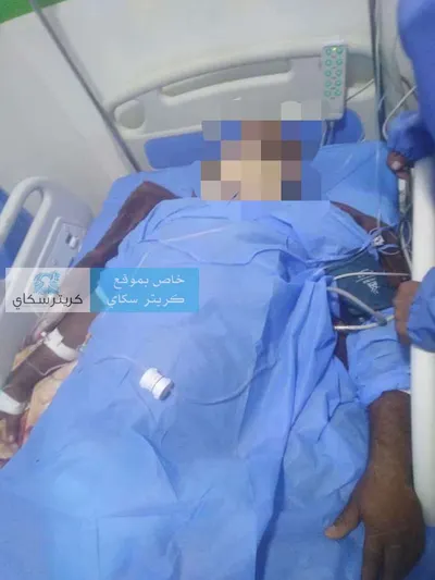 اخبار اليمن الان ويلوذ بالفرار والضحية الحياة والموت اخبار اليمن الان الحدث اليوم عاجل