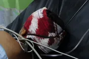 وكالة الصحافة اليمنية اخبار اليمن الان العناصر السلفية الموالية للرياض بالضالع اخبار اليمن الان الحدث اليوم عاجل وكالة الصحافة اليمنية