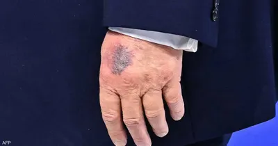 اخبار اليمن الان ترامب يكشف أحدث كدمة تظهر اخبار اليمن الان الحدث اليوم عاجل