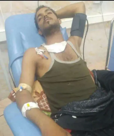 اخبار اليمن الان وفاة متأثرا بإصابته القتال الحوثيين اخبار اليمن الان الحدث اليوم عاجل