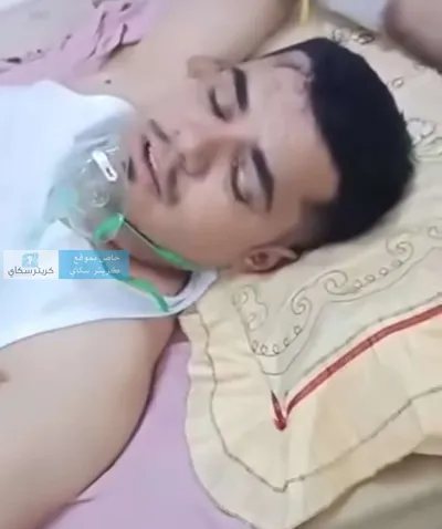 اخبار اليمن الان شهادة صادمة تفاصيل احتراق جماعي اخبار اليمن الان الحدث اليوم عاجل