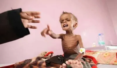 اخبار اليمن الان حكومة التحالف تبتلع مقدمة بولندا اخبار اليمن الان الحدث اليوم عاجل