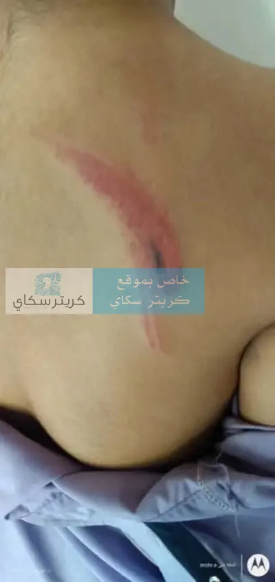اخبار اليمن الان اتهامات صادمة لمدير مدرسة كهربائي اخبار اليمن الان الحدث اليوم عاجل