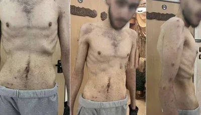 اخبار اليمن الان صحيفة هآرتس الاحتلال تحولت مراكز اخبار اليمن الان الحدث اليوم عاجل