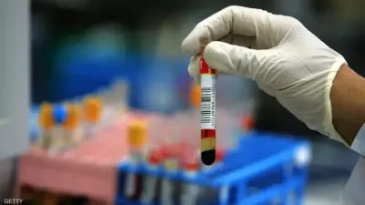 اخبار اليمن الان تحاليل ضرورية الأربعين اكتشفها بالنتائج اخبار اليمن الان الحدث اليوم عاجل