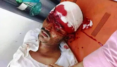 اخبار اليمن الان العثور جثة مسؤول أمني مقتولا اخبار اليمن الان الحدث اليوم عاجل