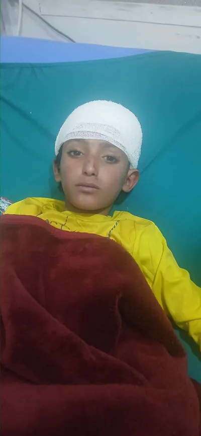 اخبار اليمن الان إصابة بجروح خطيرة نتيجة بسلاح اخبار اليمن الان الحدث اليوم عاجل