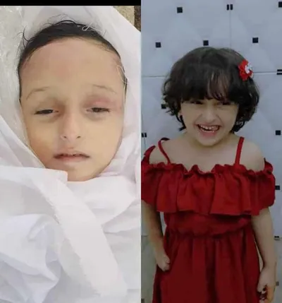 اخبار اليمن الان حقيقة هروب الطفلة البكري السجن اخبار اليمن الان الحدث اليوم عاجل