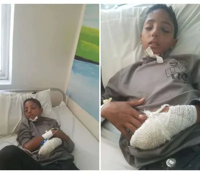 اخبار اليمن الان مناشدة عاجلة لإنقاذ طفل حيفان اخبار اليمن الان الحدث اليوم عاجل