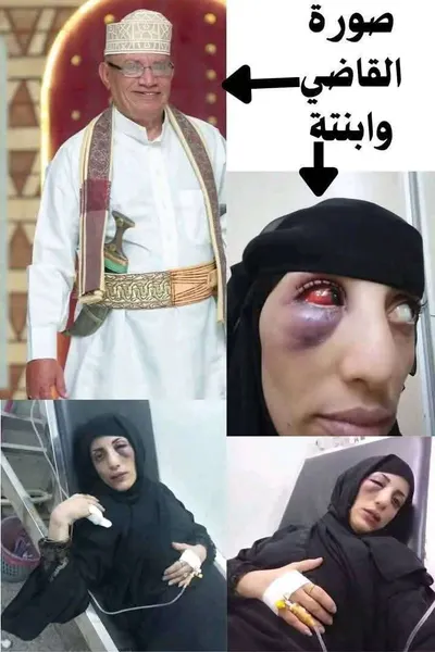 اخبار اليمن الان تعرض ابنة قاضي محكمة لاعتداء اخبار اليمن الان الحدث اليوم عاجل