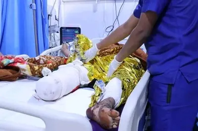 اخبار اليمن الان الحدث اليوم عاجل 