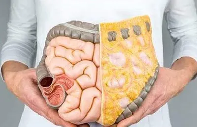 اخبار اليمن الان الطبيب لتنظيف القولون ومعالجة الإمساك اخبار اليمن الان الحدث اليوم عاجل