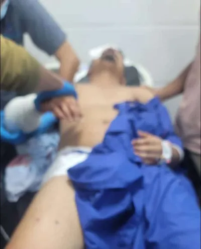 اخبار اليمن الان تفاصيل جديدة حادثة إطلاق النار اخبار اليمن الان الحدث اليوم عاجل