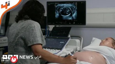 اخبار اليمن الان السعودية حصيلة الاعتداءات والملك الدوليين اخبار اليمن الان الحدث اليوم عاجل