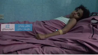 اخبار اليمن الان إصابة طفلة بشظية قذيفة ثية اخبار اليمن الان الحدث اليوم عاجل