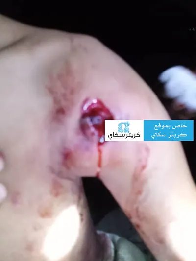 اخبار اليمن الان كريتر سكاي يرصد أولية لإصابة اخبار اليمن الان الحدث اليوم عاجل