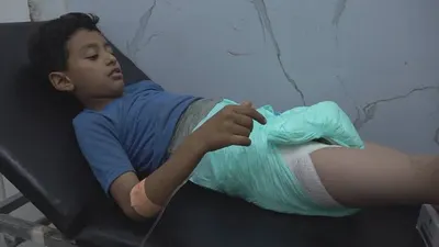 اخبار اليمن الان إصابة طفل برصاص قناص صورة اخبار اليمن الان الحدث اليوم عاجل