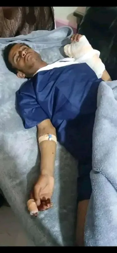 اخبار اليمن الان الحدث اليوم عاجل 