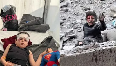 اخبار اليمن الان الطفل جراح ذاكرة الوحشية الإسرائيلية اخبار اليمن الان الحدث اليوم عاجل