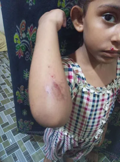 اخبار اليمن الان نجاة طفلة هجوم ومطالبات بتحرك اخبار اليمن الان الحدث اليوم عاجل