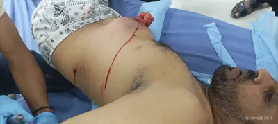 اخبار اليمن الان المتظاهرين السلميين معاشيق مستشفى العسكري اخبار اليمن الان الحدث اليوم عاجل