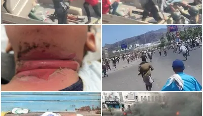 اخبار اليمن الان الحدث اليوم عاجل 