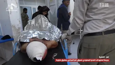 اخبار اليمن الان ومشاهد الجريمة السعودية المدنيين بمحافظة اخبار اليمن الان الحدث اليوم عاجل