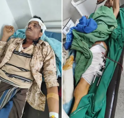 اخبار اليمن الان الحدث اليوم عاجل 