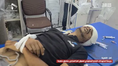 اخبار اليمن الان ومشاهد الجريمة السعودية المدنيين بمحافظة اخبار اليمن الان الحدث اليوم عاجل