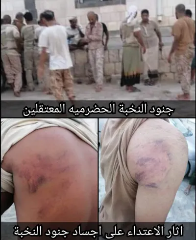 اخبار اليمن الان الحدث اليوم عاجل 