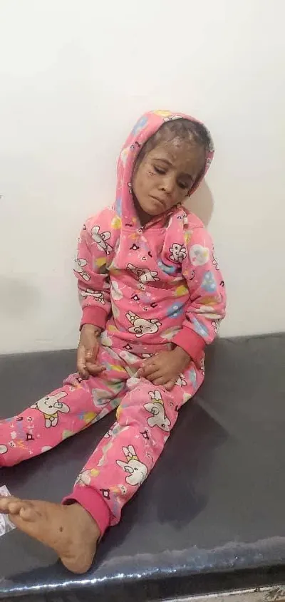 اخبار اليمن الان يمنية لتعذيب والدها وزوجته محافظة اخبار اليمن الان الحدث اليوم عاجل