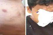 عرب تايم اخبار اليمن الان وتقارير الحديدة الإصابة بفيروس الحـوثي اخبار اليمن الان الحدث اليوم عاجل عرب تايم