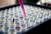 عاجل السعودية اخبار اليمن الان روسيا عقارا محليا جديدا للجدري اخبار اليمن الان الحدث اليوم عاجل عاجل السعودية