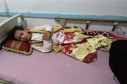 عرب تايم اخبار اليمن الان اخبار وتقارير تصاعد لانتشار الحصبة اخبار اليمن الان الحدث اليوم عاجل عرب تايم