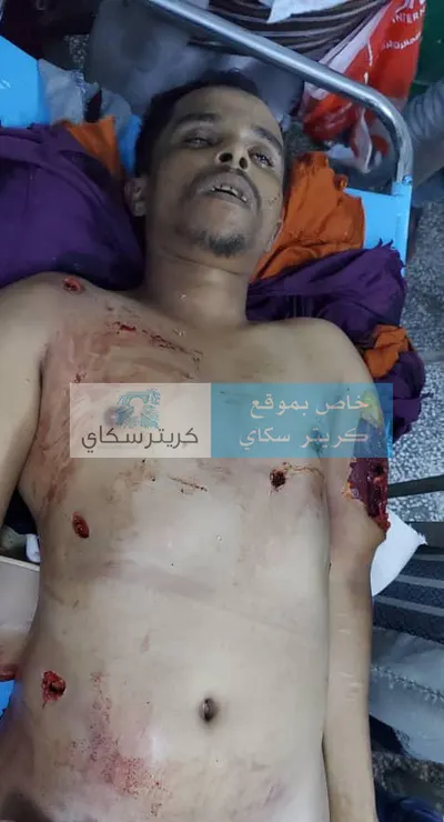 اخبار اليمن الان الحدث اليوم عاجل 