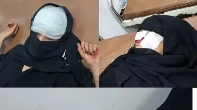 اخبار اليمن الان إصابة فتيات حوثي سكني اليمنية اخبار اليمن الان الحدث اليوم عاجل