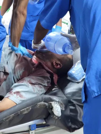 اخبار اليمن الان الحدث اليوم عاجل 