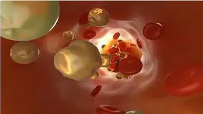 اخبار اليمن الان استشاري الغدة الدرقية ارتفاع الكوليسترول اخبار اليمن الان الحدث اليوم عاجل