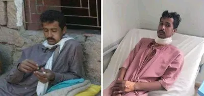 اخبار اليمن الان الحدث اليوم عاجل 