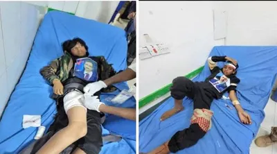 اخبار اليمن الان الحدث اليوم عاجل 